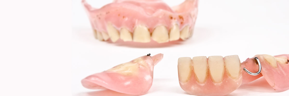 Dentures Bellevue WA - Replace Missing Teeth