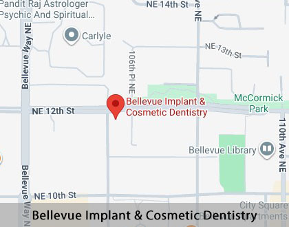 Map image for Dental Veneers and Dental Laminates in Bellevue, WA