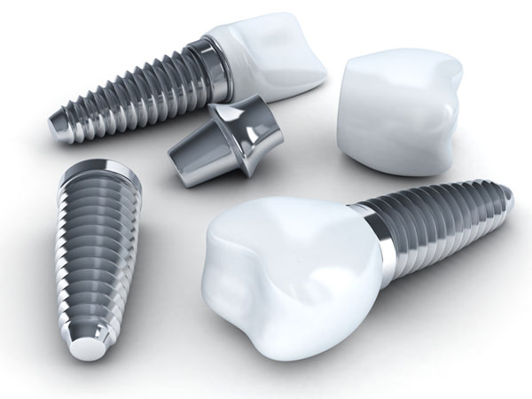 Zirconium Implants Bellevue WA - Zirconium Dental Implant Bellevue -  Zirconium Tooth Implant Bellevue