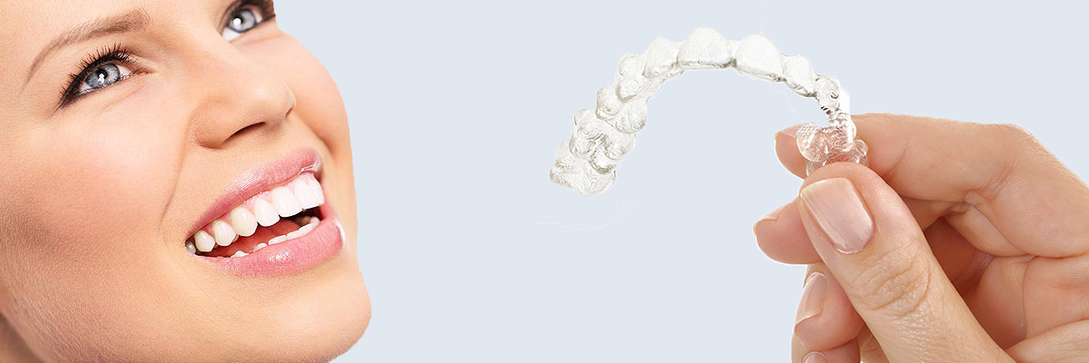 Bellevue 7 Things Parents Need to Know About Invisalign Teen