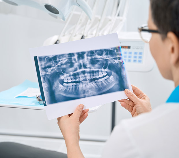 Bellevue Periodontal Probing