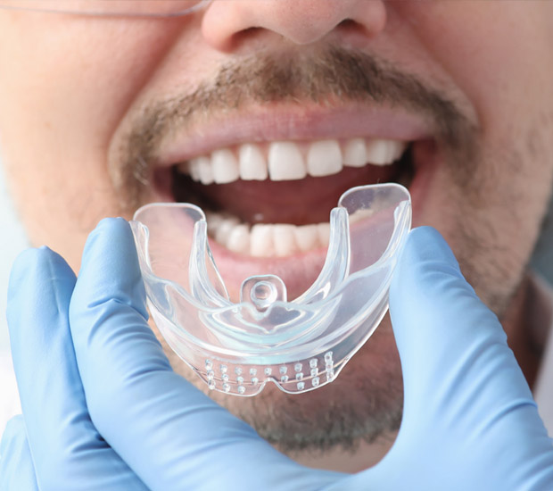 Bellevue Reduce Sports Injuries With Mouth Guards