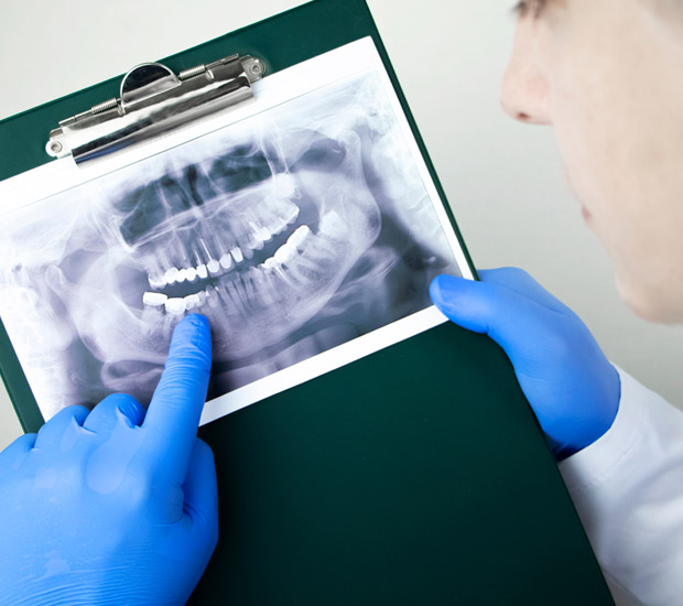 Bellevue What is an Endodontist